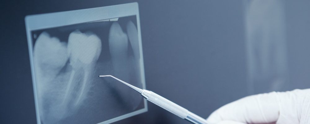 fernando-sandoval-endodoncia-general